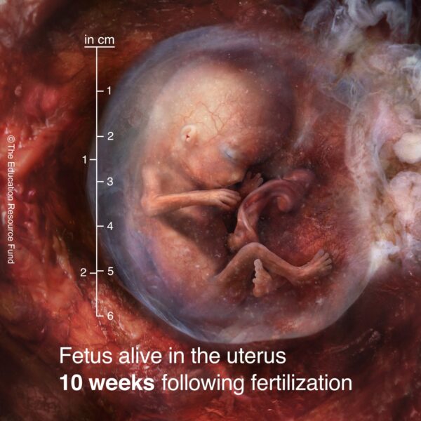 10-week-fetus-min