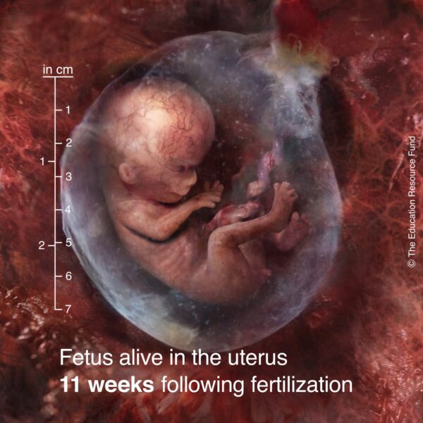 11-week-fetus-min