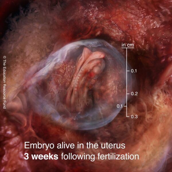 3-week-embryo-min