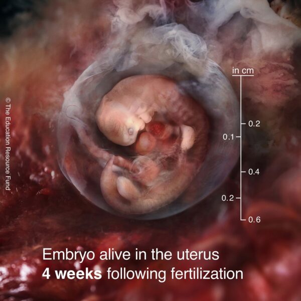 4-week-embryo-min