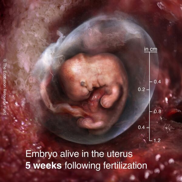 5-week-embryo-min
