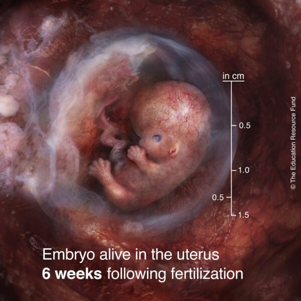 6-week-embryo-min