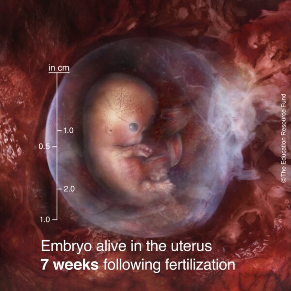 7-week-embryo-min