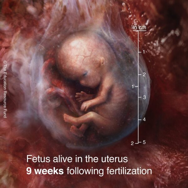 9-week-fetus-min